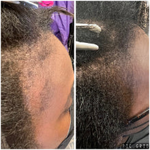 Load image into Gallery viewer, Restore My Edges