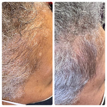 Load image into Gallery viewer, Restore My Edges